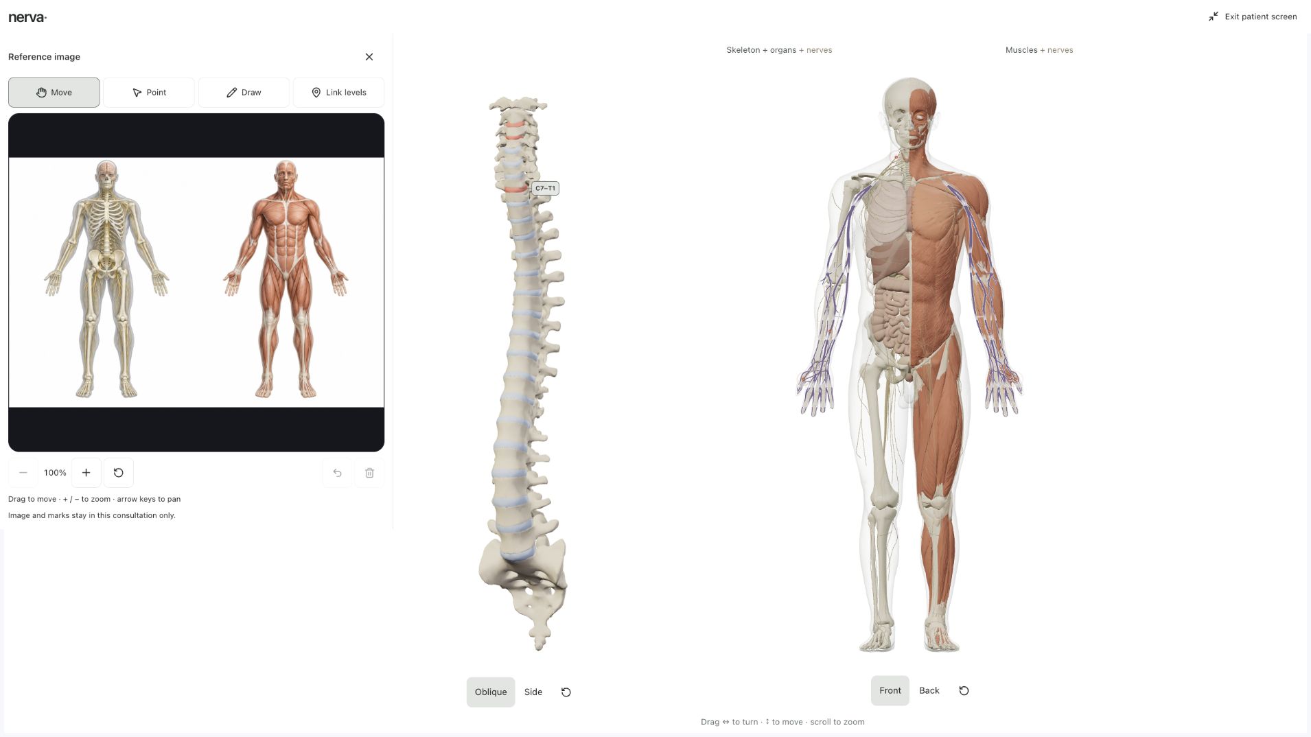 Body in View patient screen with an anatomy reference image beside the spine and split body.